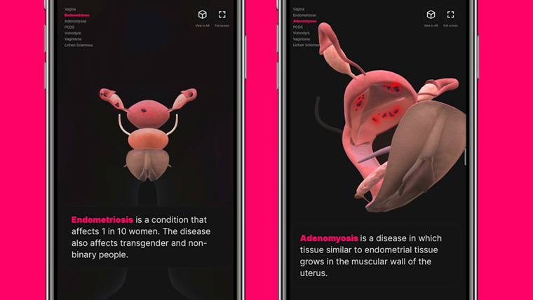 The feature also explores painful conditions women experience.
